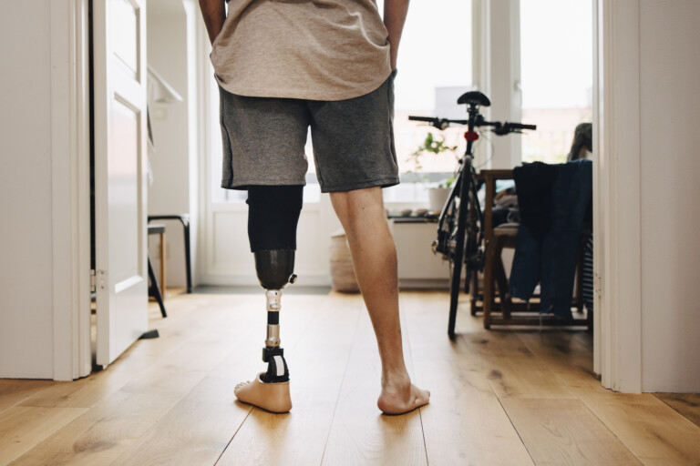 health-insurers-limit-coverage-of-prosthetic-limbs,-questioning-their-medical-necessity-–-kff-health-news